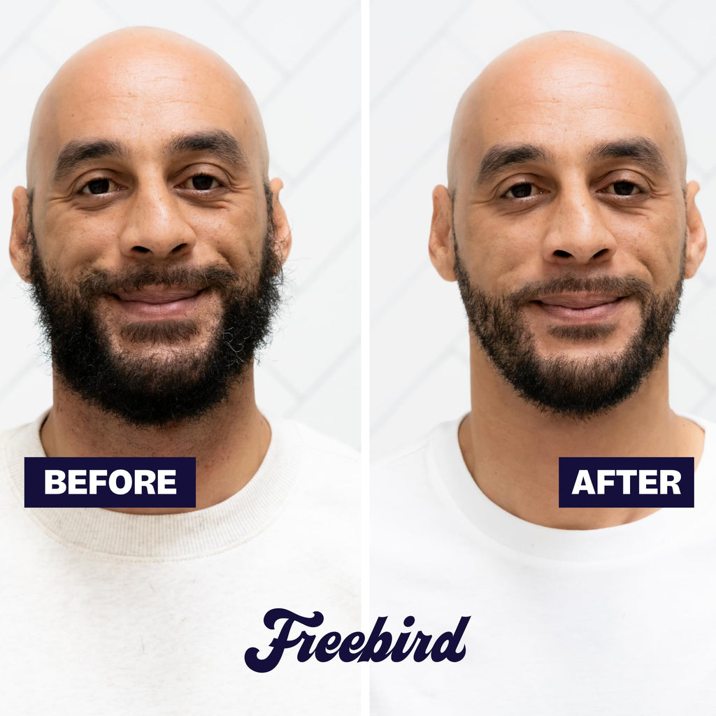 Freebird BeardSeries Trimmer for Men - Ultra Sharp Beard Trimmer with Precision Dial, Stainless Steel Blades, 40 Length Settings, Cordless & Rechargeable, for Beard, Hair, Body, & Intimate Grooming