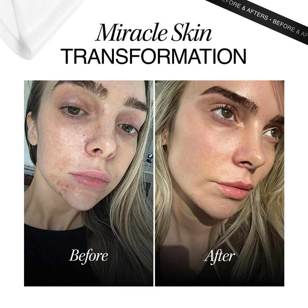 Cosmetic Consult Miracle Skin Transformation By Ashley Stobart | Rejuvenates & Refreshes Skin Overnight, Smooths Wrinkles & Acne, Boosts Collagen, Anti-Ageing Skin Cleanser | 1 x Single Wipe