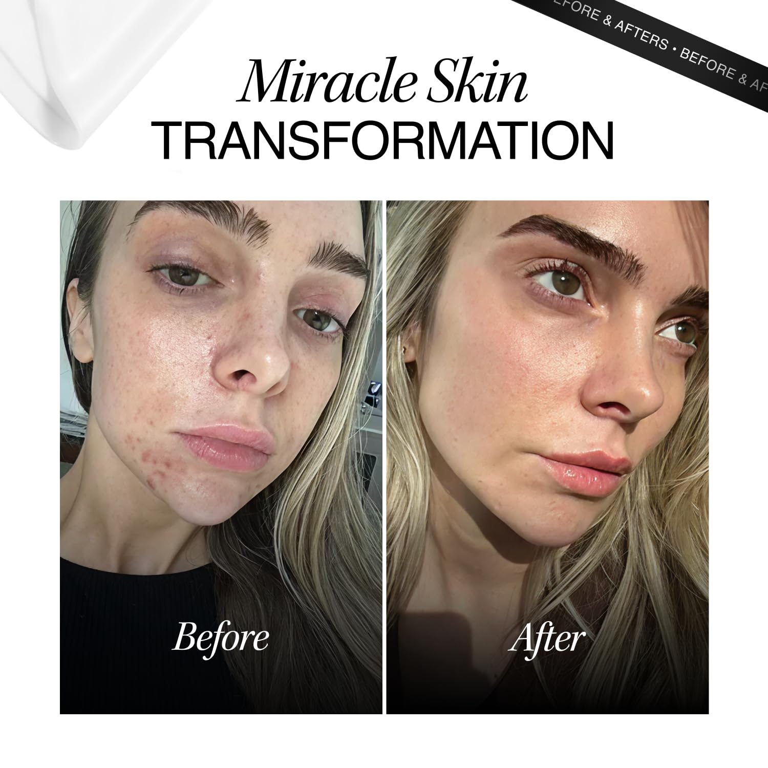 Cosmetic Consult Miracle Skin Transformation By Ashley Stobart | Rejuvenates & Refreshes Skin Overnight, Smooths Wrinkles & Acne, Boosts Collagen, Anti-Ageing Skin Cleanser | 1 x Single Wipe