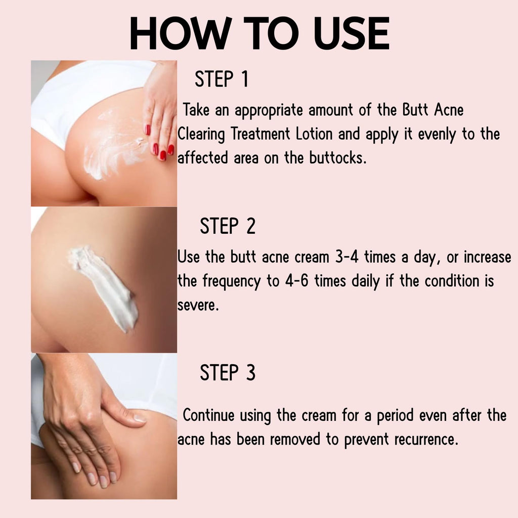 Butt Acne Cream for Women, Butt Acne Clearing with Tea Tree Oil, Body Acne Lotion for Back, Body Moisturiser for Booty Breakouts & Spot, Pimple Cream for Sensitive Skin, Delicate & Smooth
