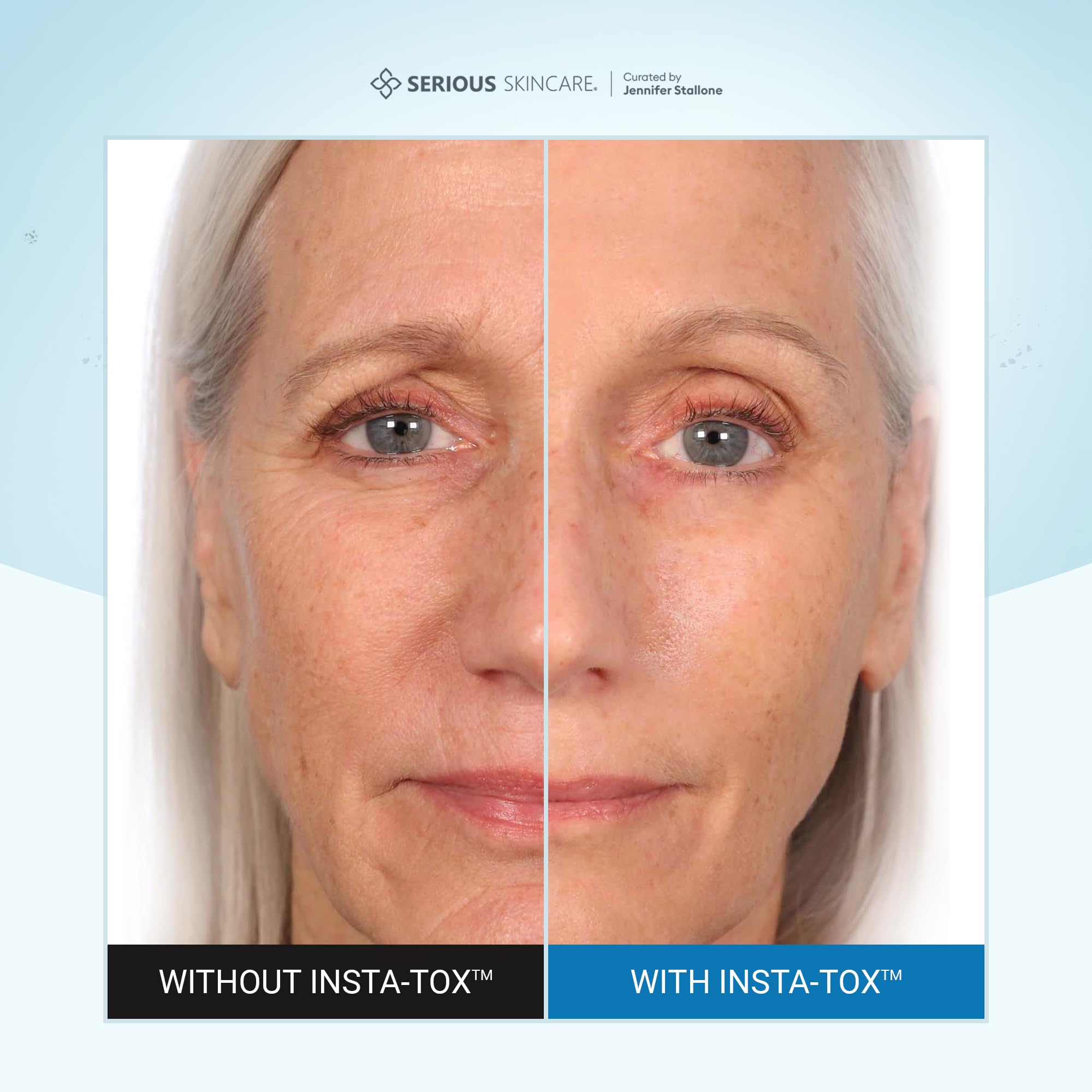 Serious Skincare INSTA-TOX Instant Wrinkle Filler for Face Serum, to Smooth + Blur Fine Lines, Deep Wrinkles, Lip Lines, Crow’s Feet & Pores, Temporary Face Tightener, for Smoother Skin .75 oz