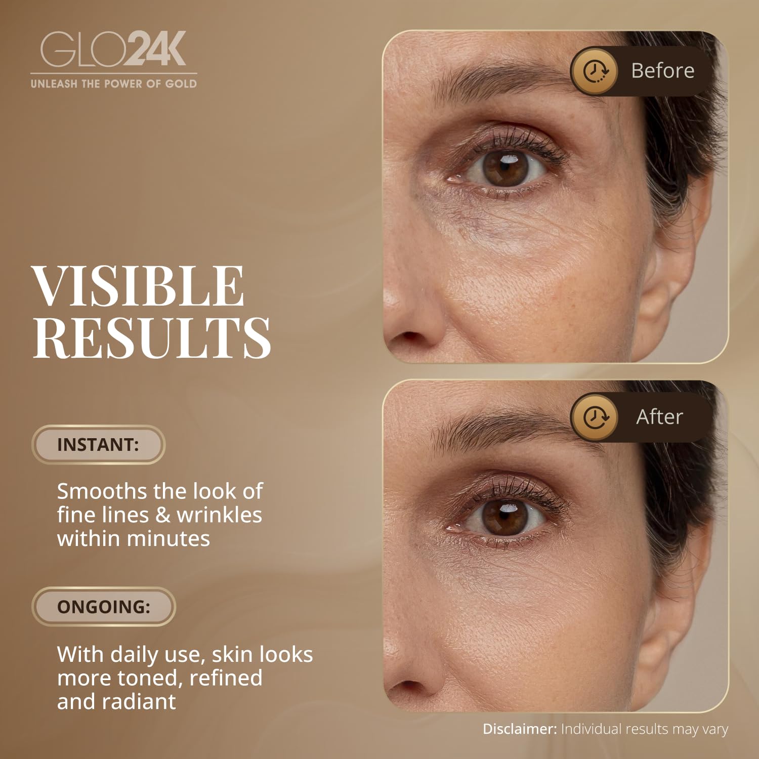 GLO24K Instant Facelift Cream with 24k Gold, Hyaluronic Acid, Peptides, and Vitamins A,C,E - Non-Invasive Alternative to Injections for Fast Results