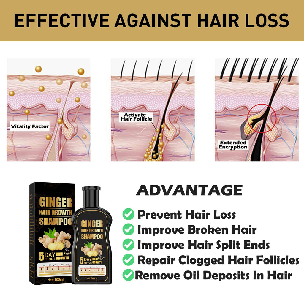 Natural Organic Ginger Shampoo Promotes Hair Growth, Anti-dandruff & Anti-itching for Hair Loss Women & Men (1pcs)