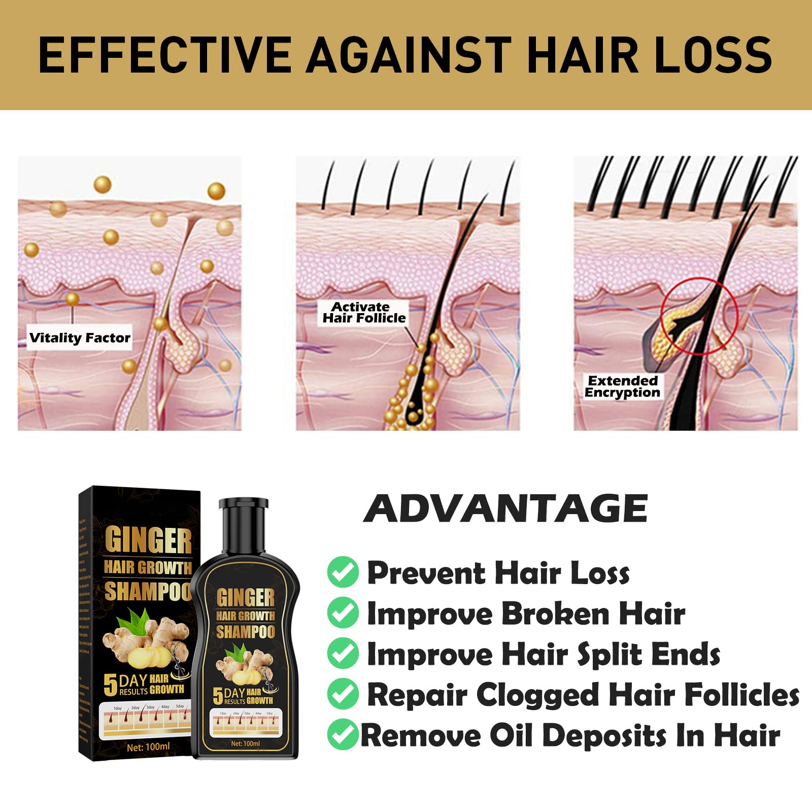 Natural Organic Ginger Shampoo Promotes Hair Growth, Anti-dandruff & Anti-itching for Hair Loss Women & Men (1pcs)