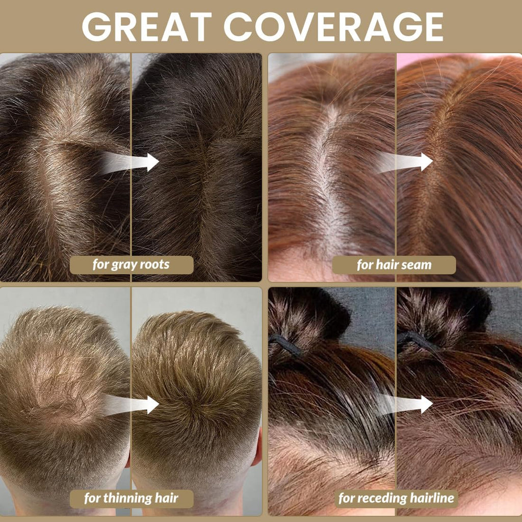 VOLLUCK Root Touch up Powder, Instant Hairline Powder for Thinning Areas and Gray Hair Coverage, Natural and Non-greasy Root Cover up for Women and Men (Auburn, 0.14 Ounce)