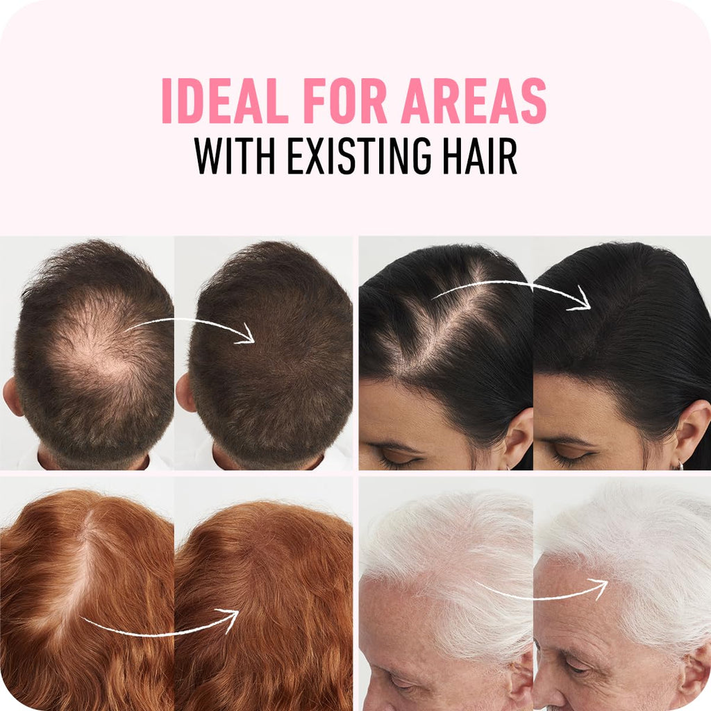 BOLDIFY Hair Fibers (56.5g) - Fill In Thinning and Fine Hair for an Instantly Fuller, Thicker Look - 14 Shades for Women & Men - Light Brown