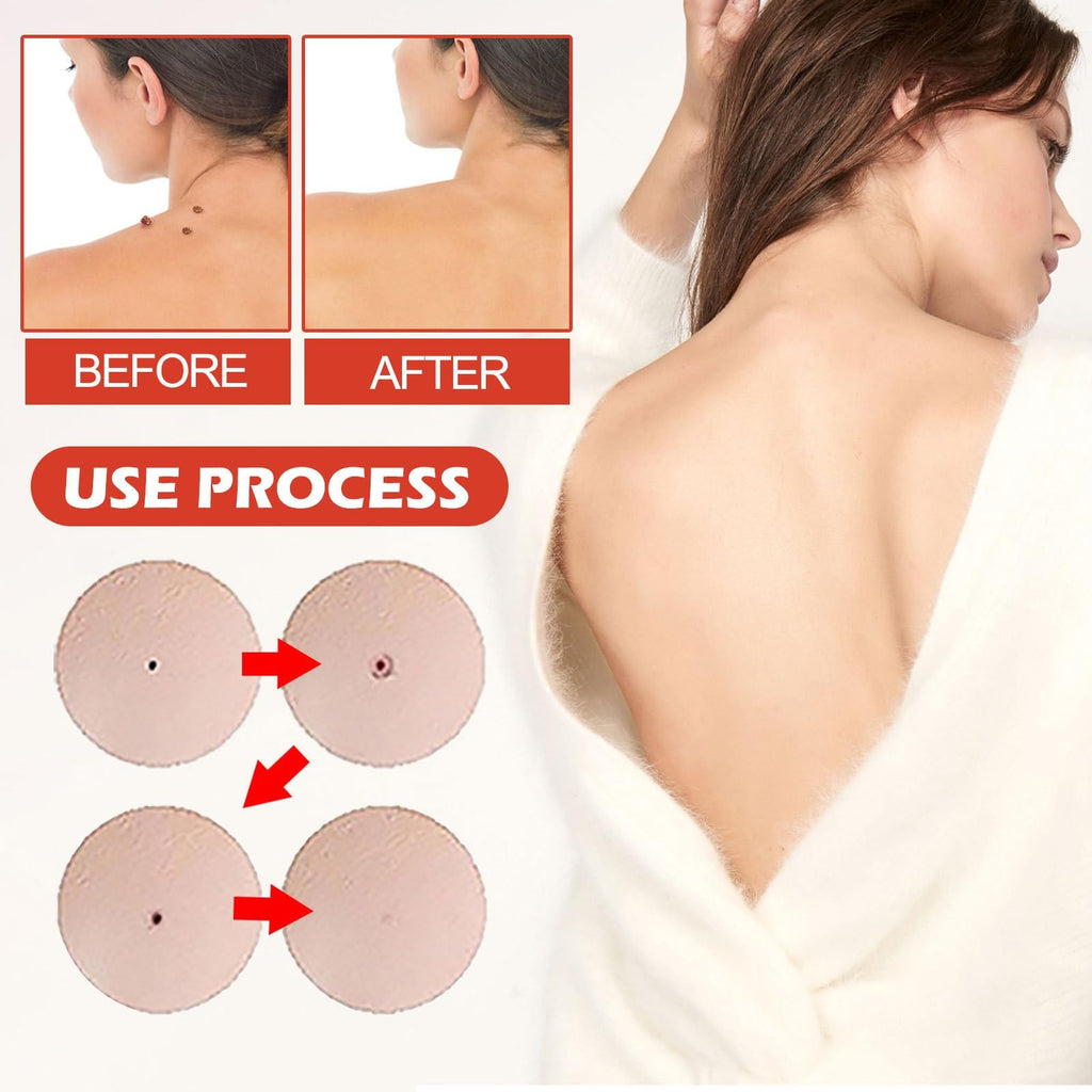 288PCS T-ag'gone Patch,Spot Stickers,Nano Patch for Face and Skin,Face Care P/atch,Acne Pimple Patches,Skin T-ag Remover Patches,M-ole Remover,Skin Ta-g P/atches,Skin Ta-g R/emover,W-art Treatment