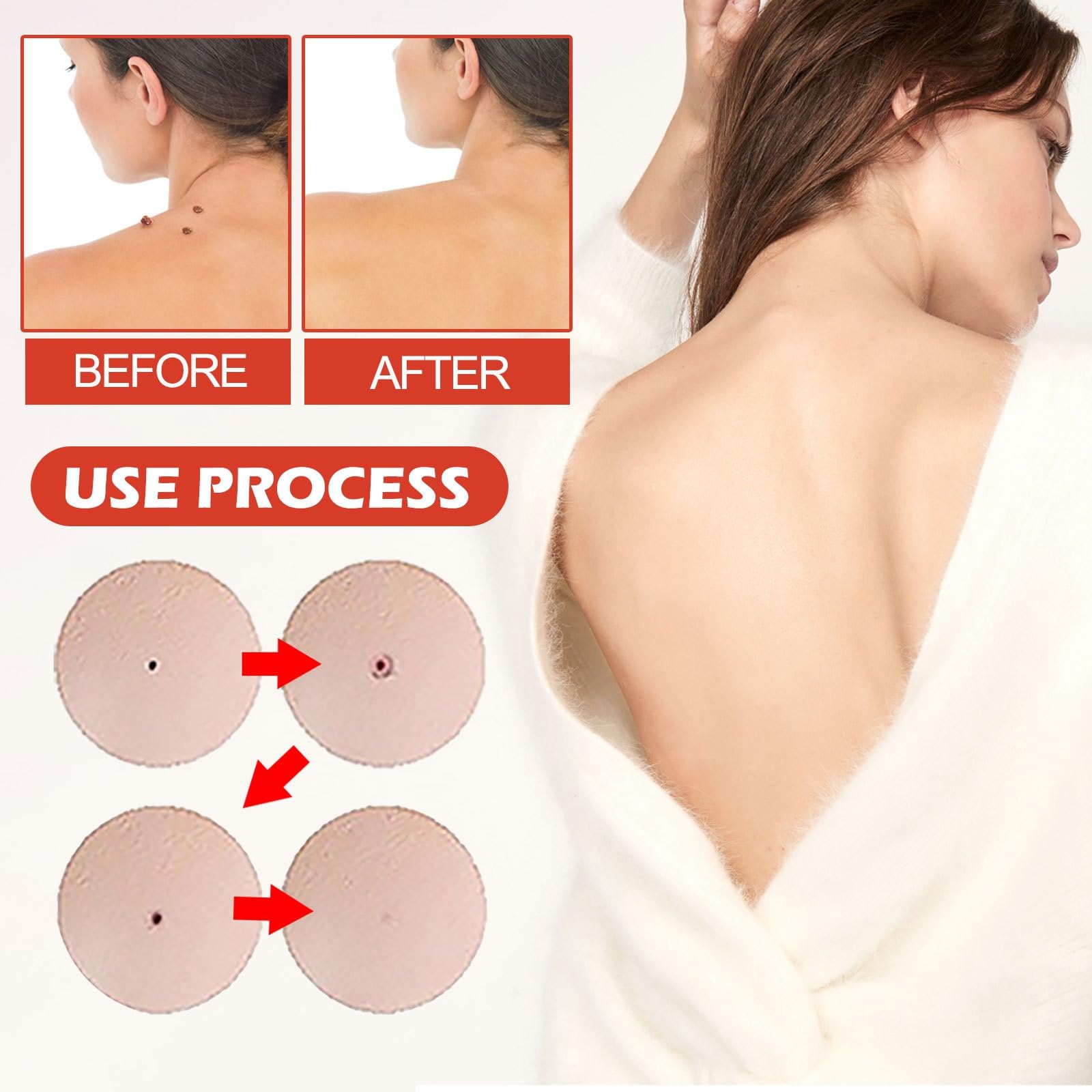 288PCS T-ag'gone Patch,Spot Stickers,Nano Patch for Face and Skin,Face Care P/atch,Acne Pimple Patches,Skin T-ag Remover Patches,M-ole Remover,Skin Ta-g P/atches,Skin Ta-g R/emover,W-art Treatment