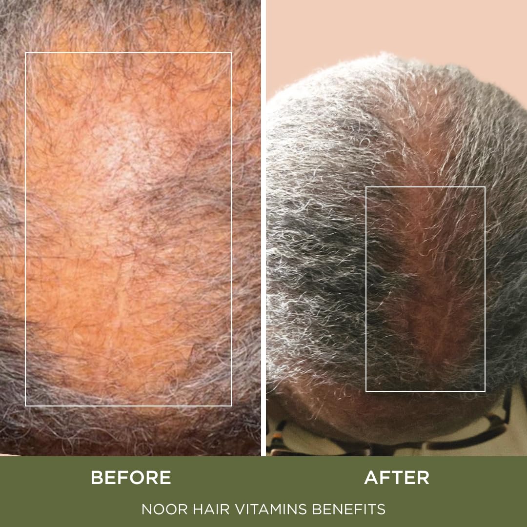 NOOR HAIR Healthy Hair Formula, Hair Growth Supplement Supporting Thick Hair and Fast Hair Regrowth. Vitamin C, B6, Zinc, Propietary Non-GMO & Gluten Free Womens Hair Loss Vitamins - 30 Day Supply