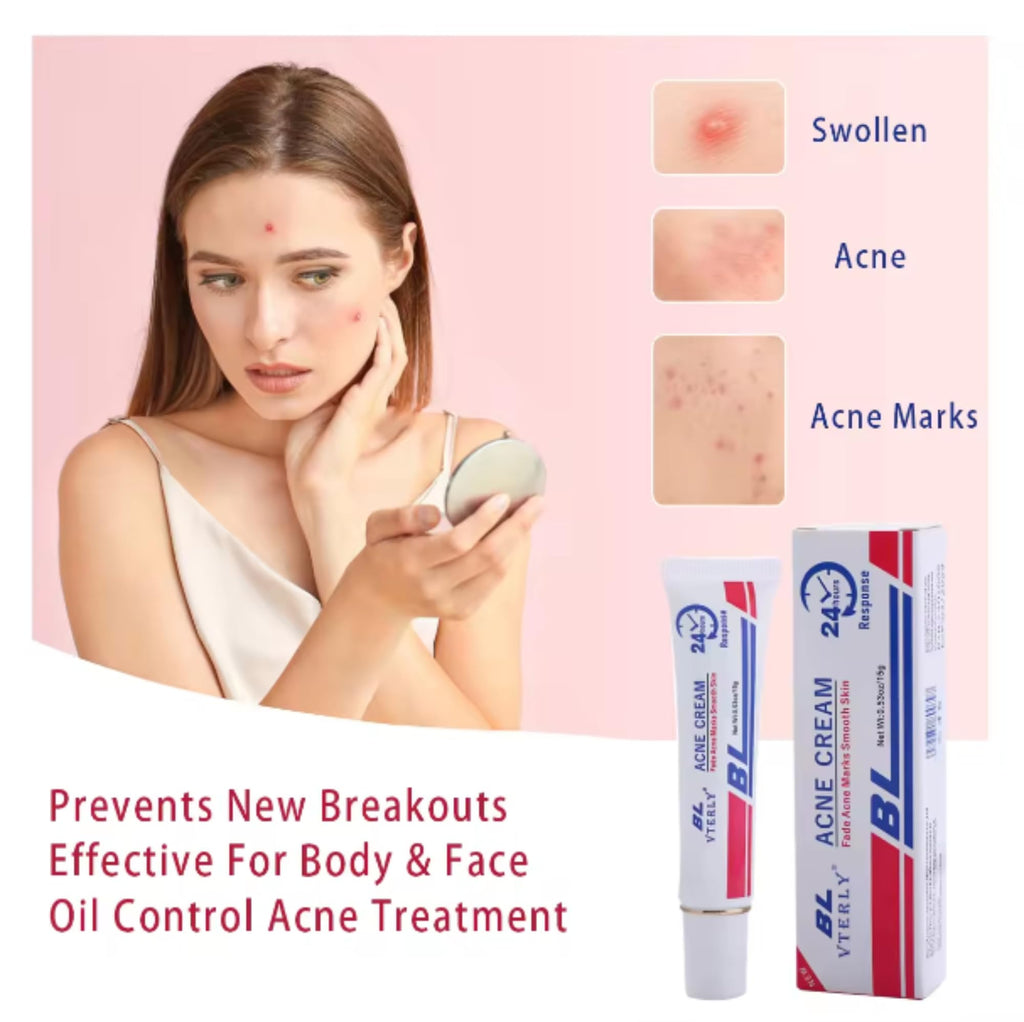 Acne Cream Scar Treatment Fast Acting - 24-Hour Spot Reduction, Anti Acne Formula, Sensitive Skin Safe, Includes Rapid Acne Scar Removal, Moisturiser, Deep Pore Cleansing - 15g