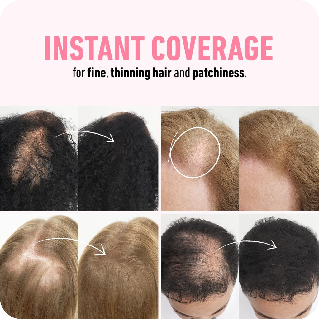 BOLDIFY Hair Fibers (56.5g) - Fill In Thinning and Fine Hair for an Instantly Fuller, Thicker Look - 14 Shades for Women & Men - Light Brown