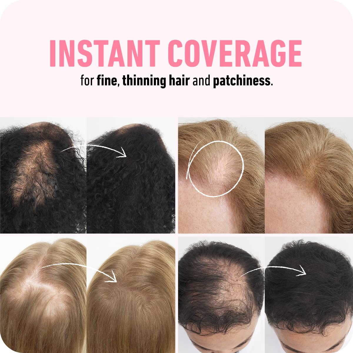 BOLDIFY Hair Fibers (56.5g) - Fill In Thinning and Fine Hair for an Instantly Fuller, Thicker Look - 14 Shades for Women & Men - Light Brown