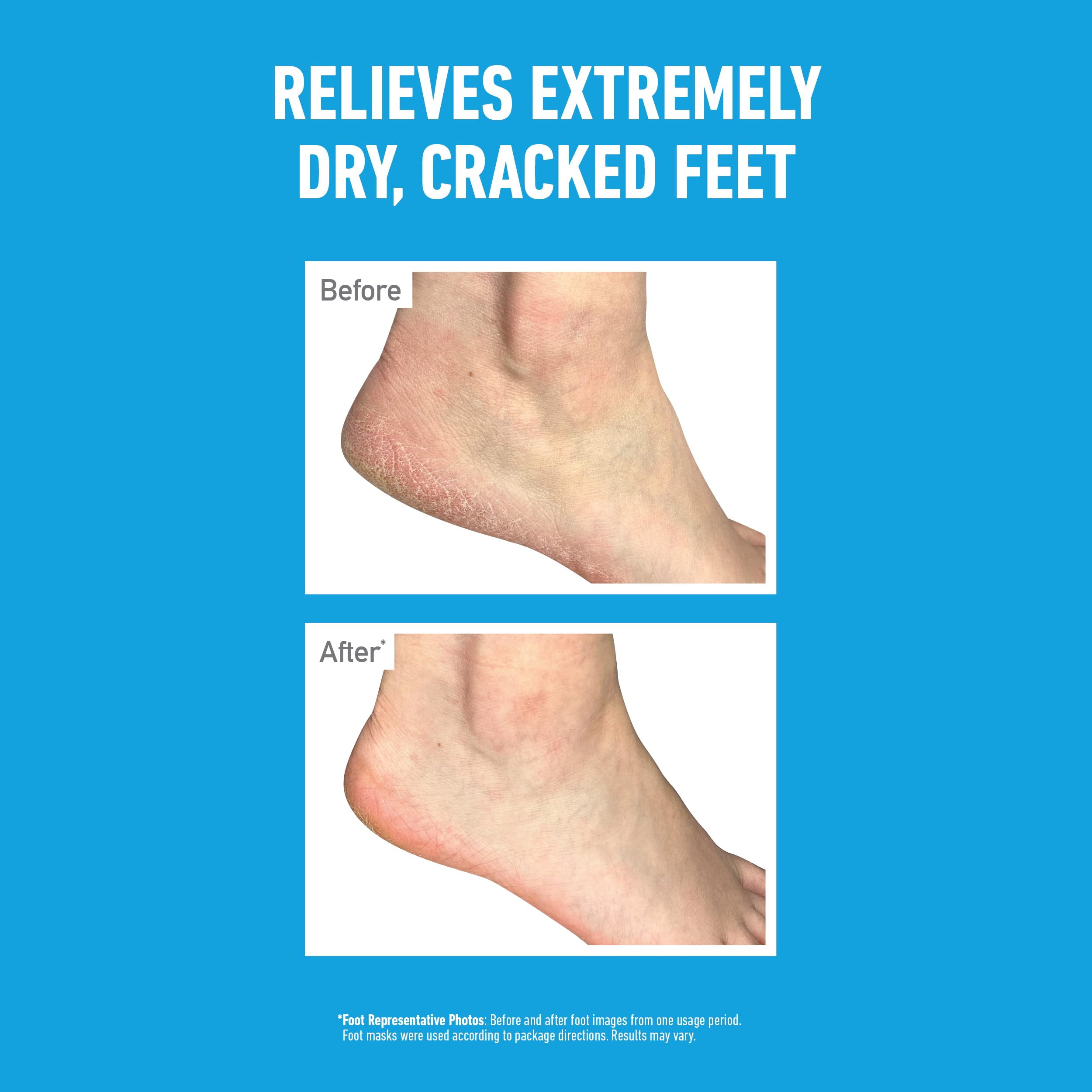 O’Keeffe’s Healthy Feet Foot Mask – Intensive Moisturising Sock Treatment for Extremely Dry, Rough Feet & Cracked Heels – Visible Results in One Use (2 Pairs)