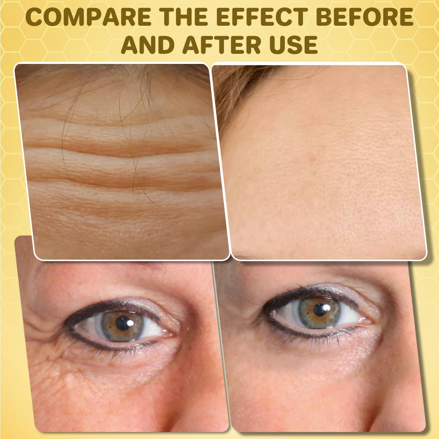 EHAUTO BeeLift Anti-Aging Firming Cream, 2025 New Professional Bee Venom Skin Firming Wrinkle Reducing Cream, 24-Hour Moisturizing Body Paste, Restore Elasticity for All Skin Types (1pcs)