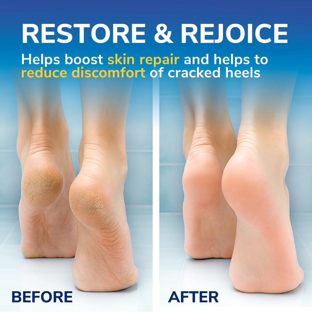 Dr. Scholl's Cracked Heel Complete Cream with Repair K+, 60ml - Moisturising Treatment Cream for Cracked Heels and Dry Skin with Keratin- 1 x 60 ml