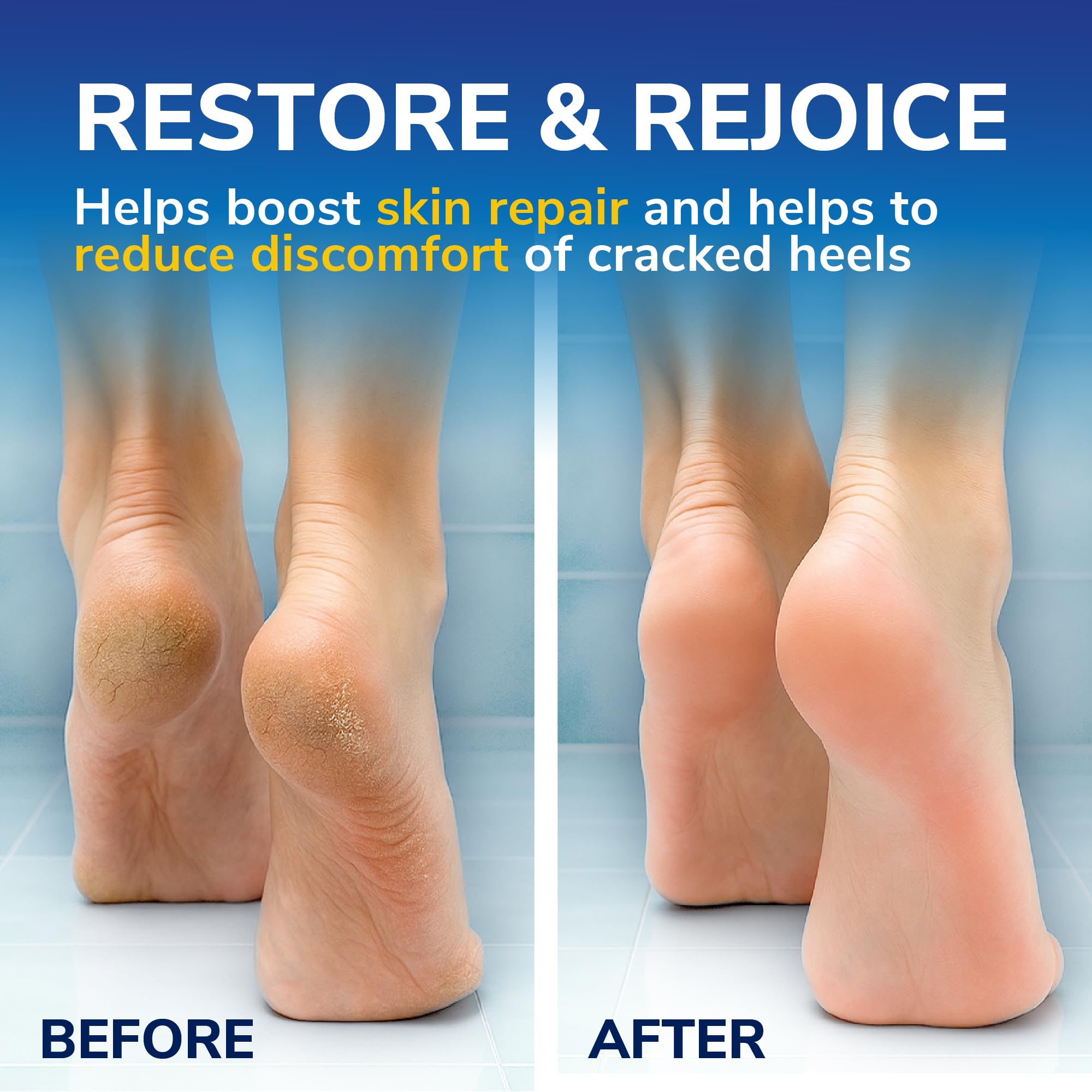 Dr. Scholl's Cracked Heel Complete Cream with Repair K+, 60ml - Moisturising Treatment Cream for Cracked Heels and Dry Skin with Keratin- 1 x 60 ml