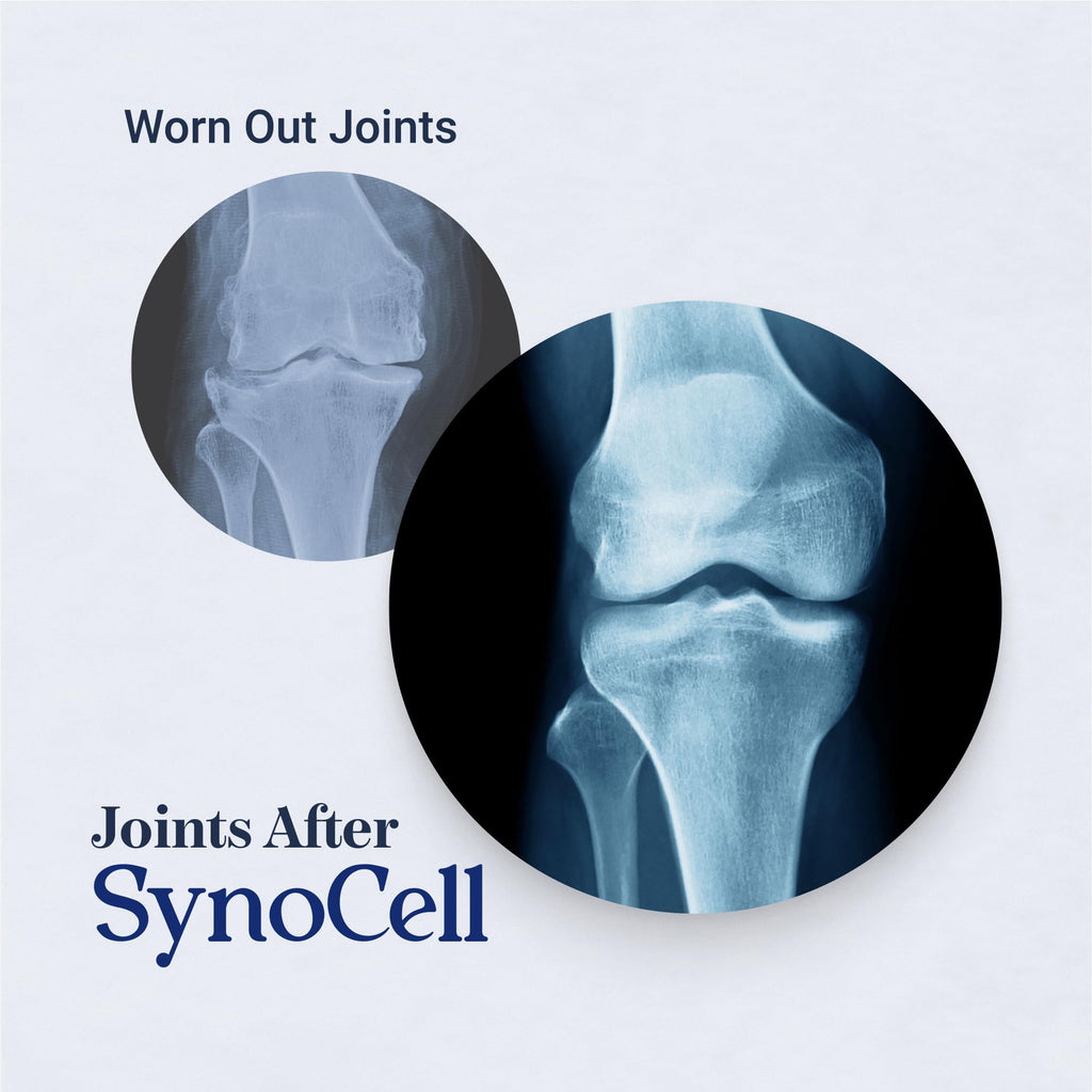 Synocell Glucosamine Chondroitin Complex Back, Neck, and Joint Support Supplement with Boswellia, Quercetin, & MSM - Renew Your Joints from the Inside Out - Move with Freedom and Ease