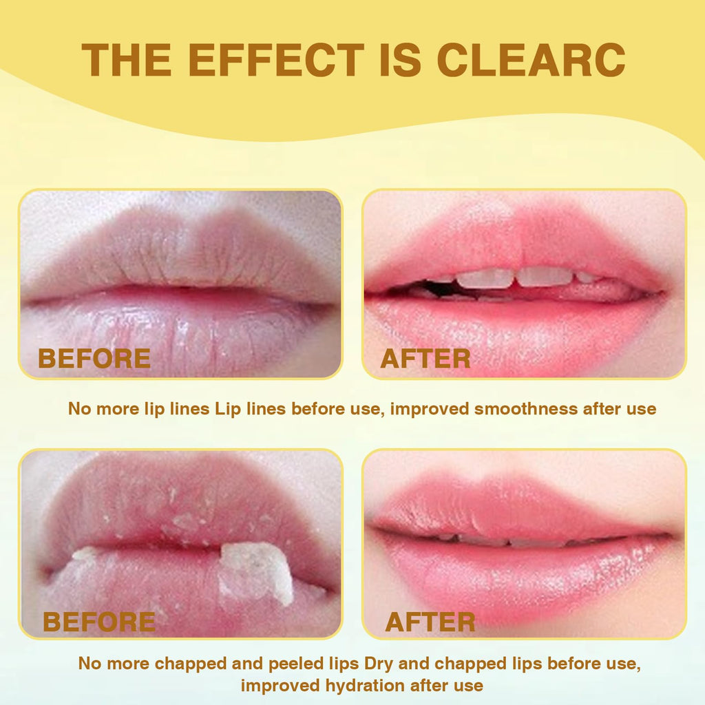 XdealCozyxc 4PCS Honey Lip Balm Uk Lip, Bee Honey Lip Balm for 24h Moisture & Wrinkle Repair