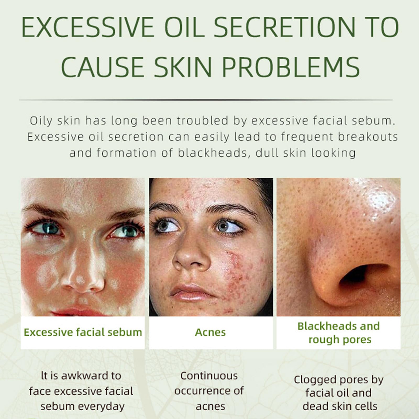Herbal Acne Removing Cream,Professionally Remove Acne Marks,Gently Moisturize,Refreshing & Not Greasy,Improving Sensitive Skin Prone to Acne,Acne Scar Cream & Pimple Remover For All Skin Types