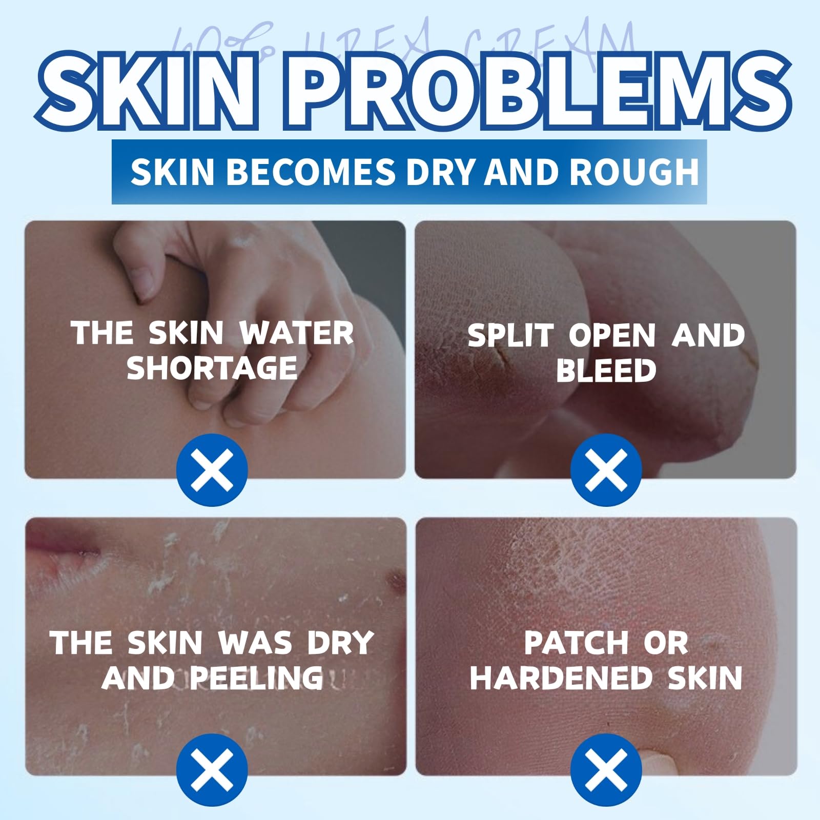 60% Urea Cream - Urea Cream 60 Percent for Feet - Cracked Heel Repair Cream - Ure_a Foot Cream Stick Plus 2% Salicylic Acid For Calluses - Foot Crea_m For Cracked Heels And Dry Skin 1pc