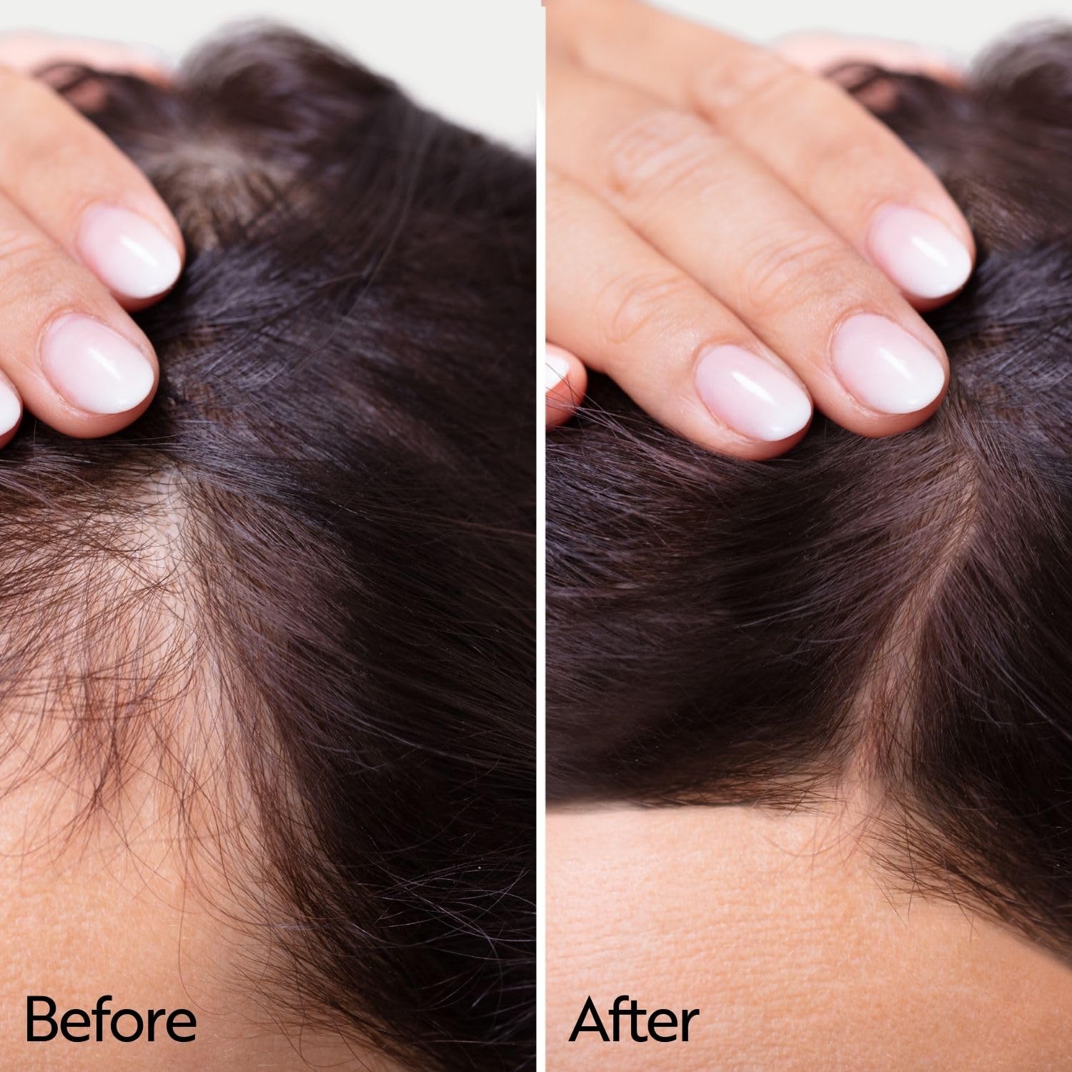 Ahuhu ESSENTIAL ANTI-AGE Elixir With Caffeine & Redensyl (100ml) - Highly Concentrated Scalp Care, Stimulates Hair Growth, Provides Thicker Hair & More Volume, Vegan