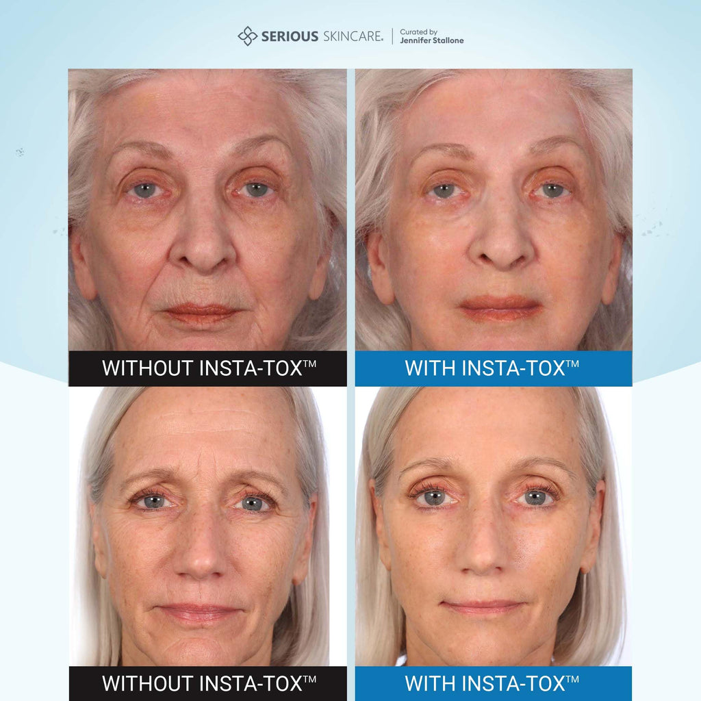 Serious Skincare INSTA-TOX Instant Wrinkle Filler for Face Serum, to Smooth + Blur Fine Lines, Deep Wrinkles, Lip Lines, Crow’s Feet & Pores, Temporary Face Tightener, for Smoother Skin .75 oz