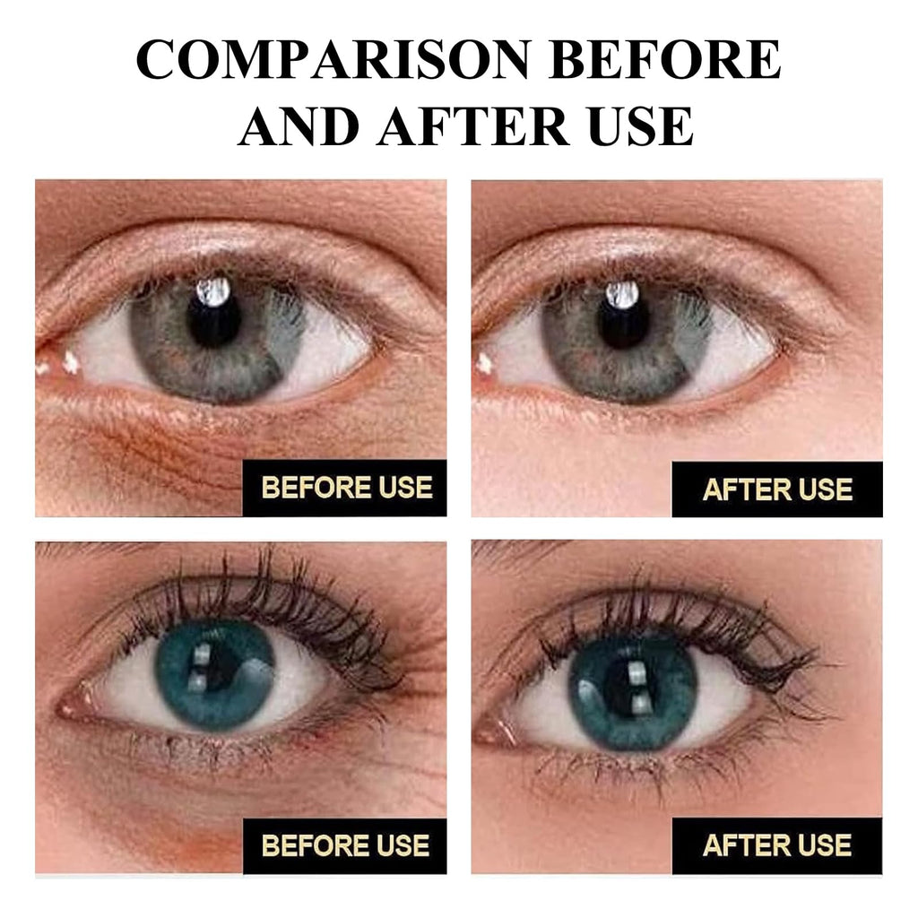 wimony Instant Eye Tightener, Eye Bag Cream Instant Firmx Eye Tightener for All Skin Eye Cream for Tightens and Smoothes for Dark Circles Fine Lines Puffiness,Fade Fine Lines (2PCS)