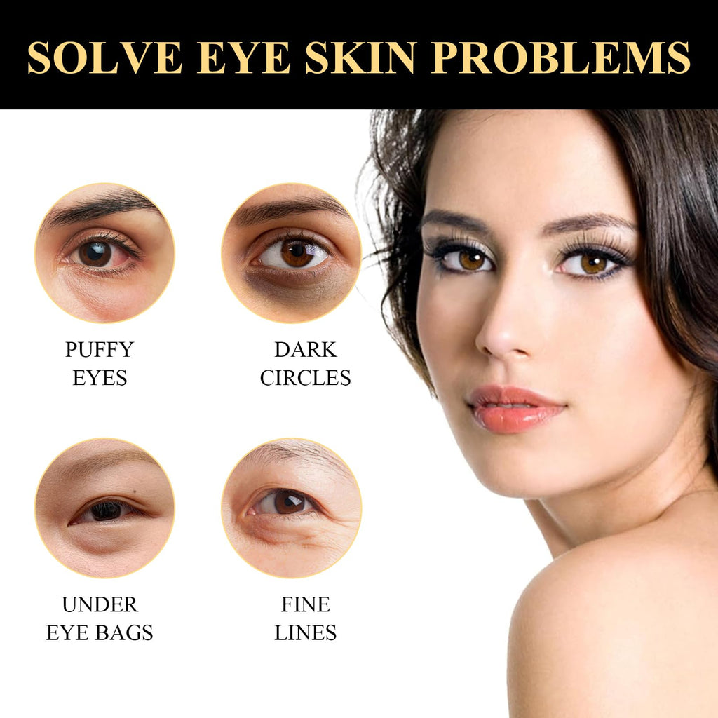 wimony Instant Eye Tightener, Eye Bag Cream Instant Firmx Eye Tightener for All Skin Eye Cream for Tightens and Smoothes for Dark Circles Fine Lines Puffiness,Fade Fine Lines (2PCS)
