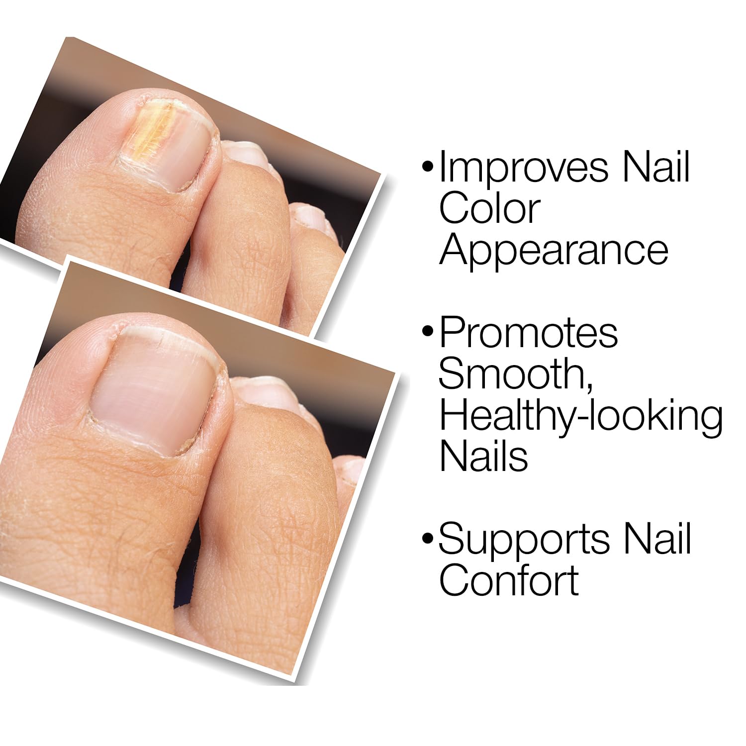 Probelle Natural Nail Renewal Gel, Clear Nail Enhancer for Discolored, Damaged, or Dull Nails, Improves Color Appearance, Promotes Smooth Healthy-Looking Nails, Made in USA (3 Pack)