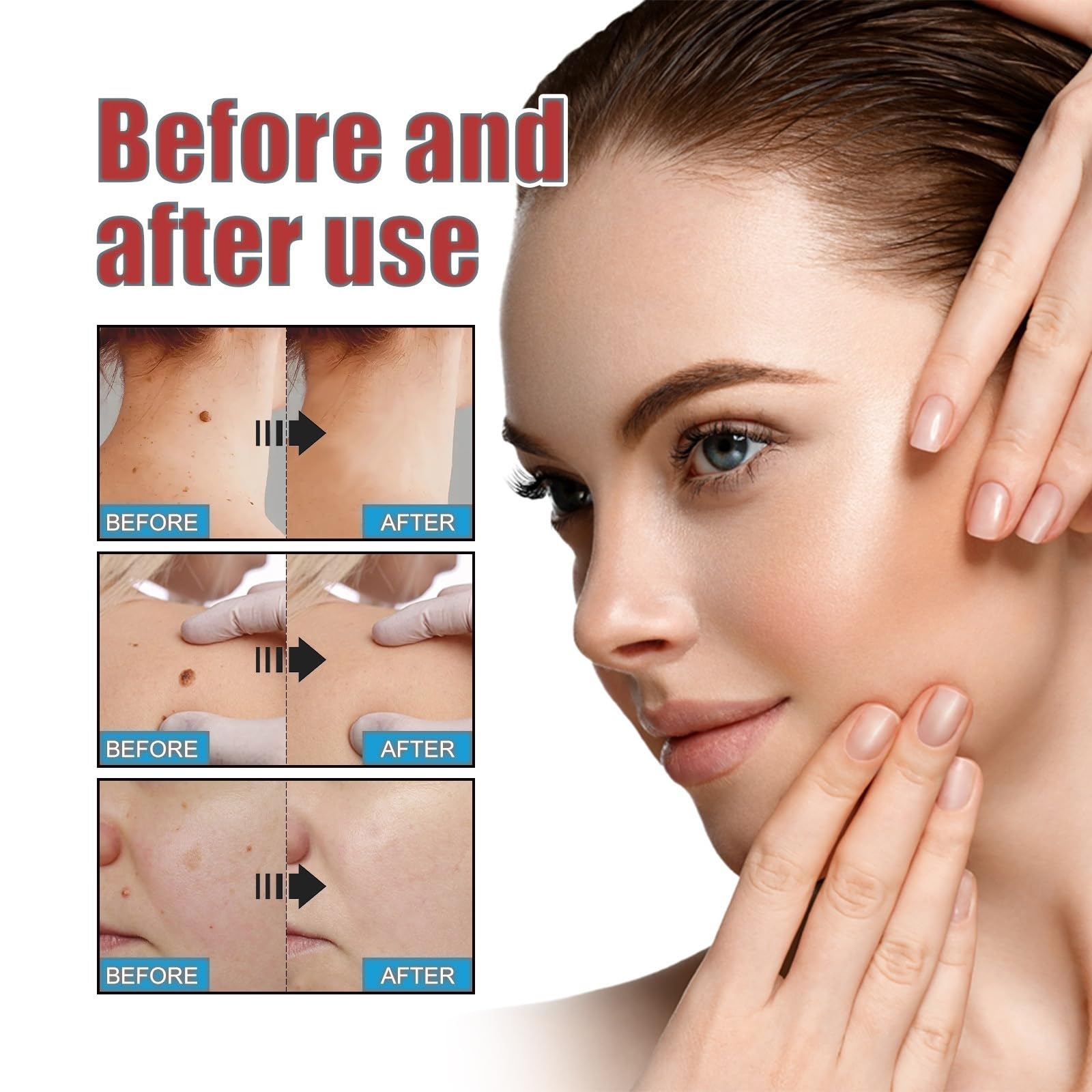 288PCS T-ag'gone Patch,Spot Stickers,Nano Patch for Face and Skin,Face Care P/atch,Acne Pimple Patches,Skin T-ag Remover Patches,M-ole Remover,Skin Ta-g P/atches,Skin Ta-g R/emover,W-art Treatment
