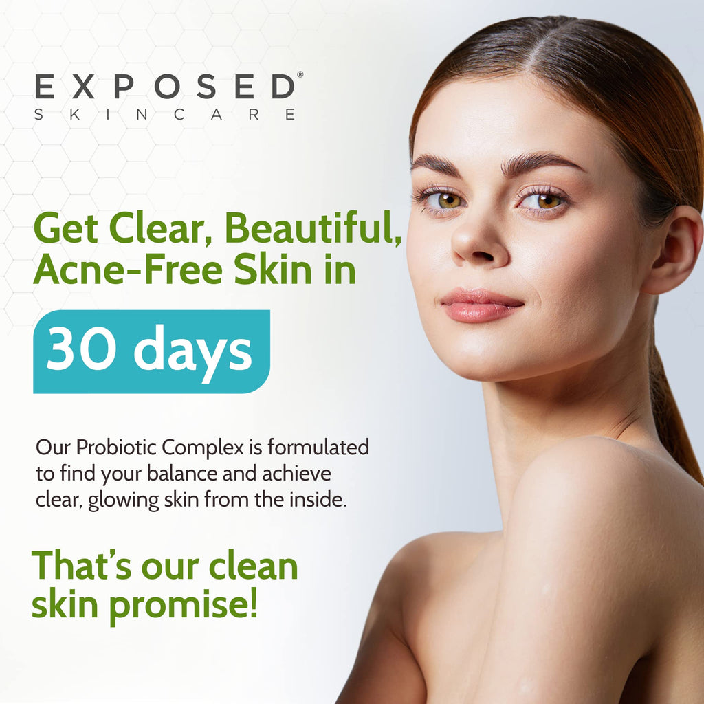 Exposed Skin Care, Probiotic Supplement Complex with 1 Billion CFU – Daily Probiotic for Skin, Gut and Immune Health Support – Digestive Wellness Formula for Men and Women – Non-GMO, 60 Capsules