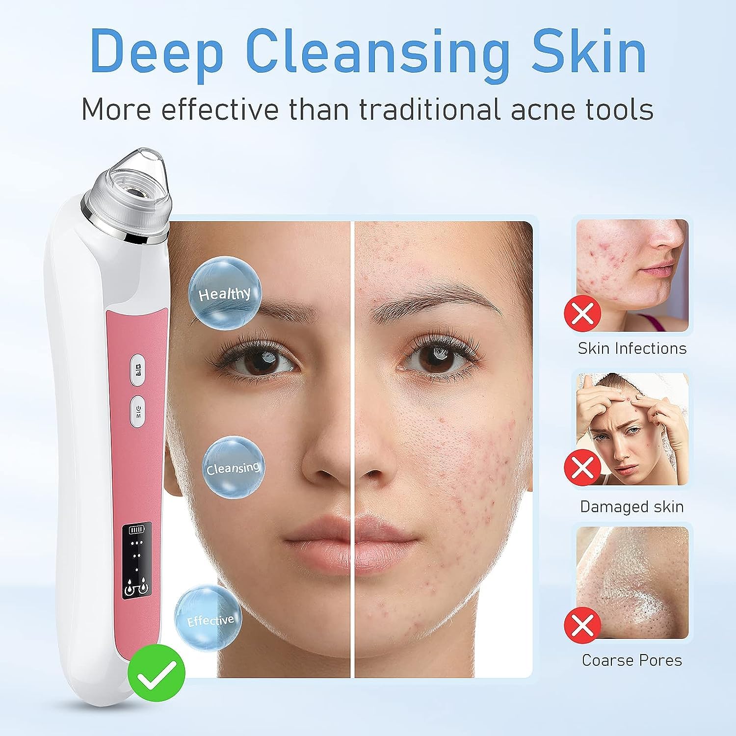 Blackhead Remover Vacuum, USB Interface Type Pore Vacuum, Black Head Extractions Tool with Camerafor, Men and Women Pore Cleaner, 3 Adjustment Modes & 6 Suction Heads(Light Pink)