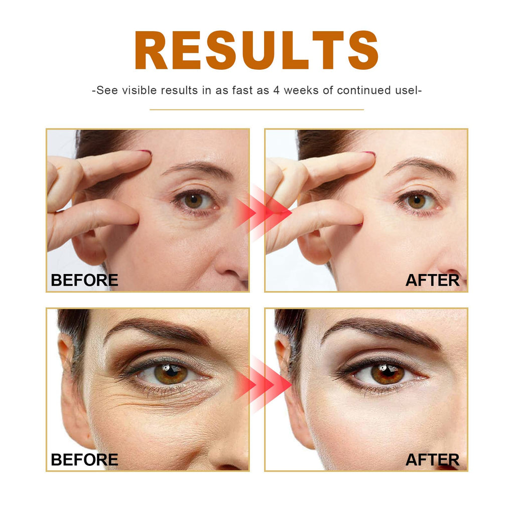 Collagen Boost - Collagen Serum For Face Serum - Serum Face With Collagen, Organic Aloe Vera, Vitamin C - Greasy - Lighten Dark Spots,Anti Aging & Wrinkle - For Youthful, Radiant & Dewy Skin,Pack of 1