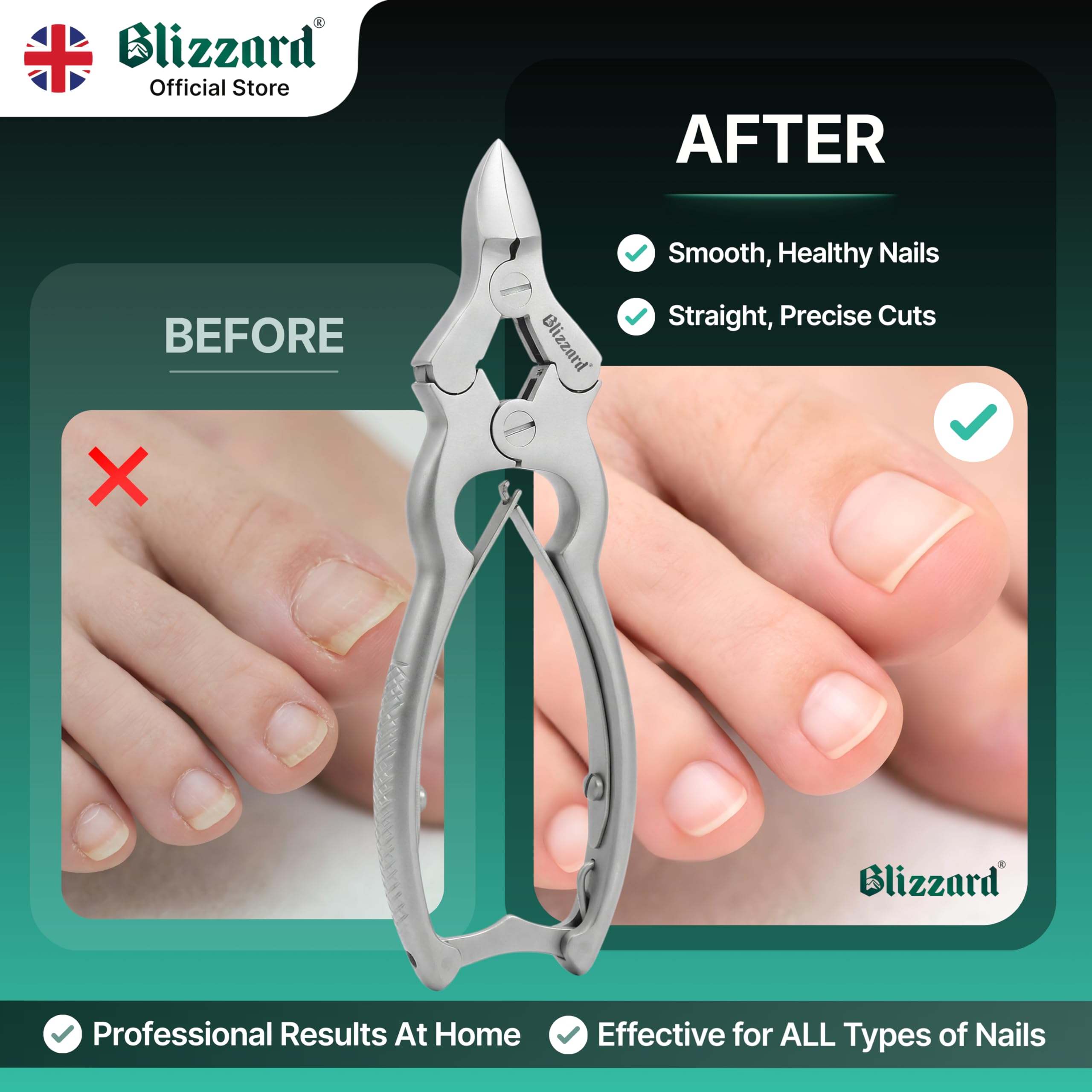 Blizzard Toe Nail Clippers for Thick Nails - Podiatrist Nail Nippers for Seniors - Heavy Duty Cantilever Toenail Clippers for Men - German Steel Podiatry Tool with Toenail File - 15cm Double Spring