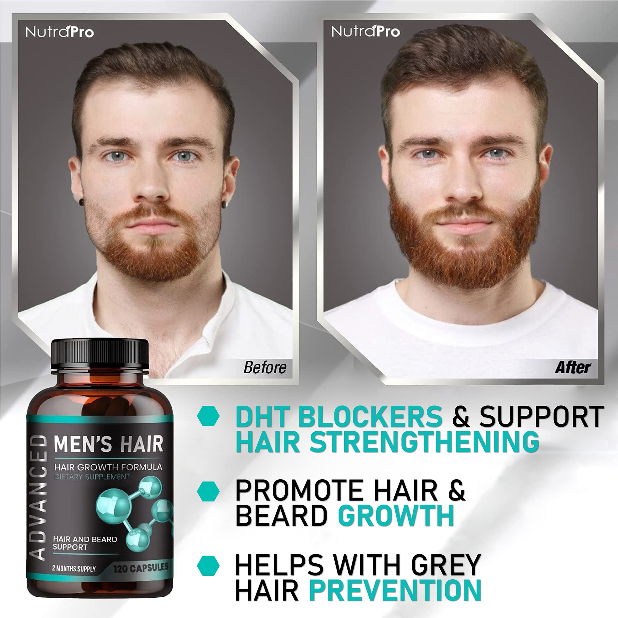 Hair Growth Vitamins For Men - Anti Hair Loss Pills. Regrow Hair & Beard Growth Supplement For Volumize, Thicker Hair.Stop Hair Loss And Thinning Hair With Biotin & Saw Palmetto Hair Vitamins.120 Caps