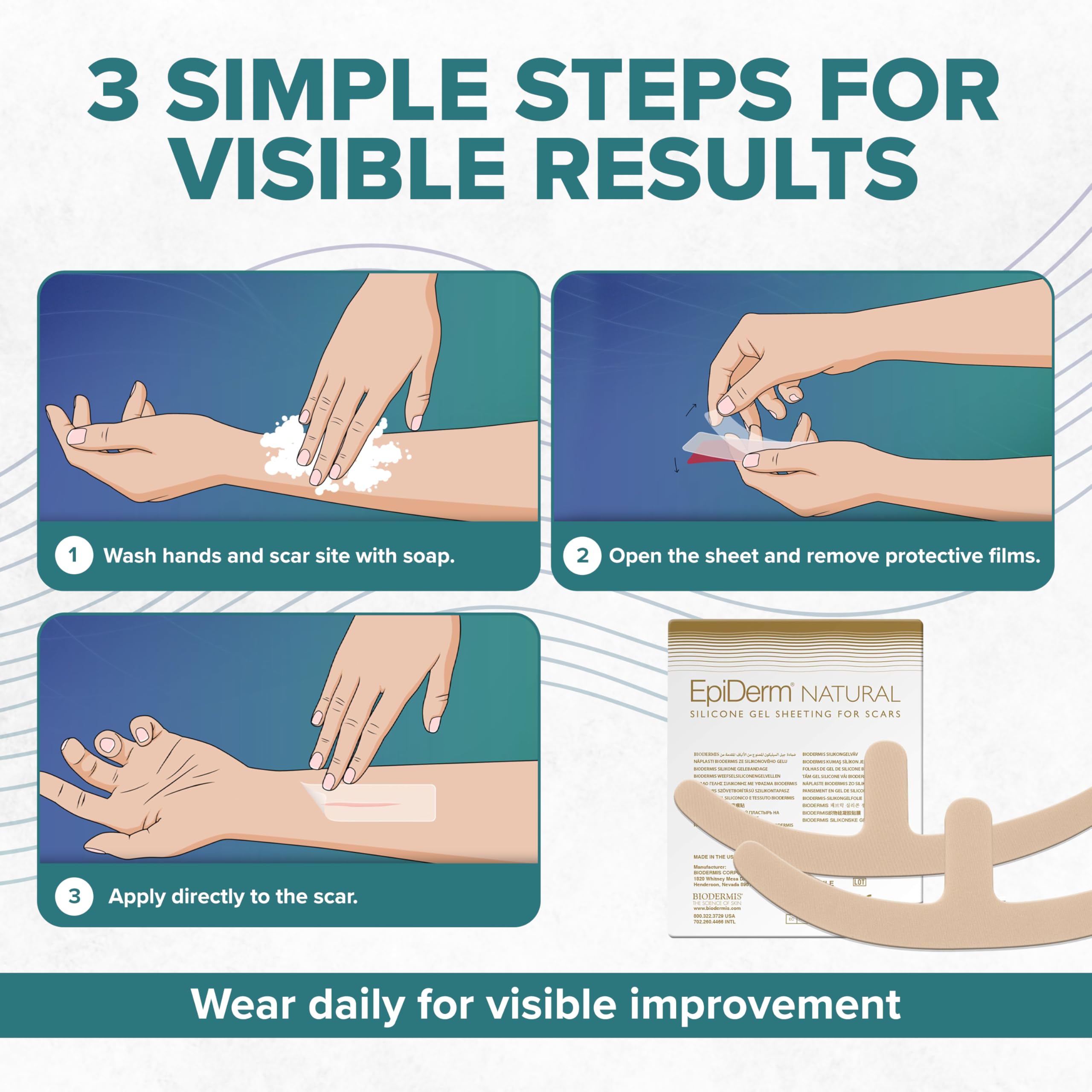 Epi-Derm Mastopexy Anchor Shape Silicone Scar Tape – Professional-Grade Silicone Scar Sheets for Breast Reduction, Breast Lift & Surgical Scar Care – Reusable, Washable Breast Scar Tape