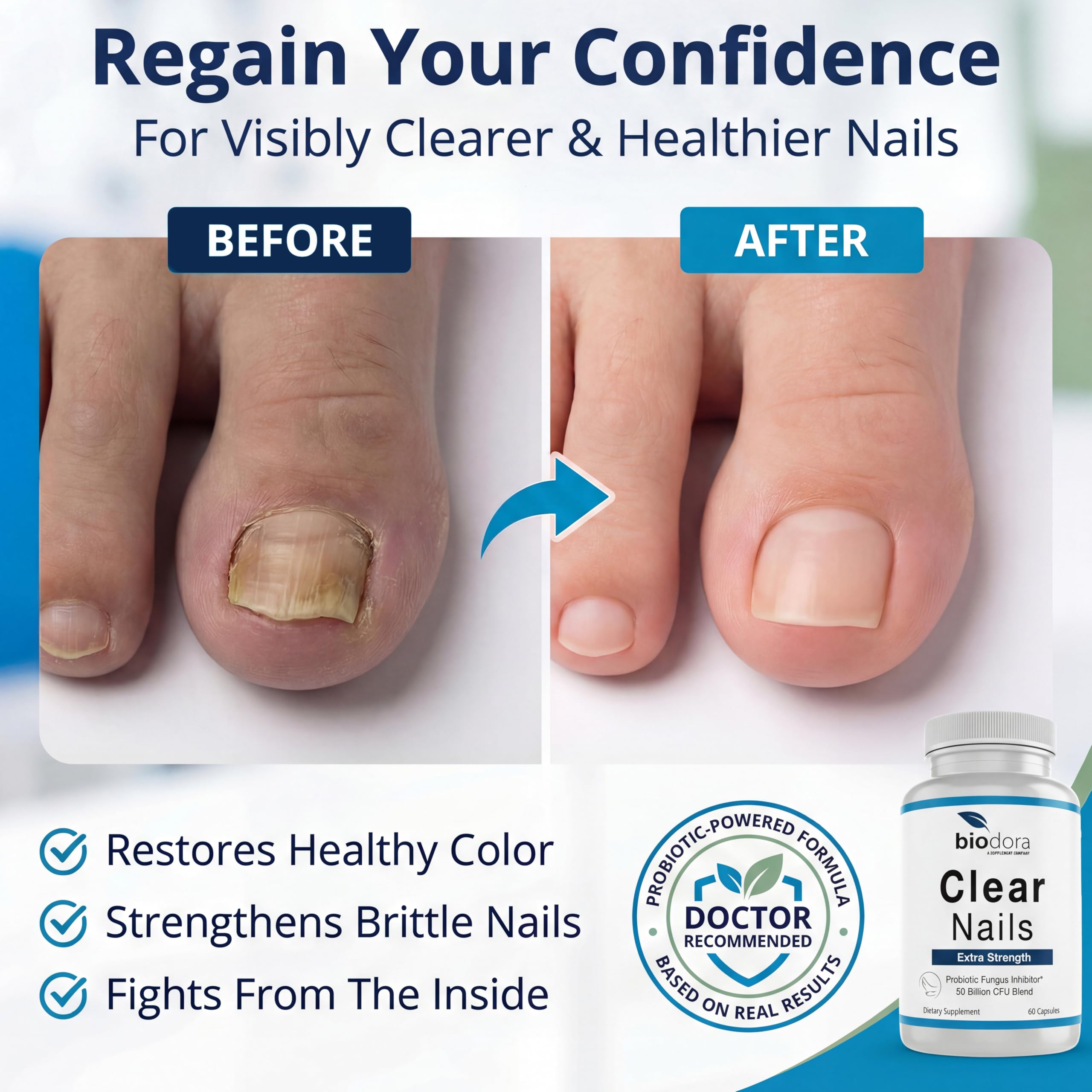 Biodora Oral Probiotic Antifungal Pills - Extra Strength Nail Fungus Eliminator | Toenail Fungal Inhibitor - Clear Nails Supplement | 50 Billion CFU (60 Capsules)