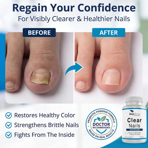 Biodora Oral Probiotic Antifungal Pills - Extra Strength Nail Fungus Eliminator | Toenail Fungal Inhibitor - Clear Nails Supplement | 50 Billion CFU (60 Capsules)