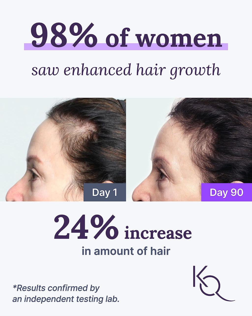 Keranique Hair & Scalp Supplements - Promote Strength and Growth Best for Thinning Nourish Your with Biotin, Vitamin B, More Vital Nutrients Keraviatin