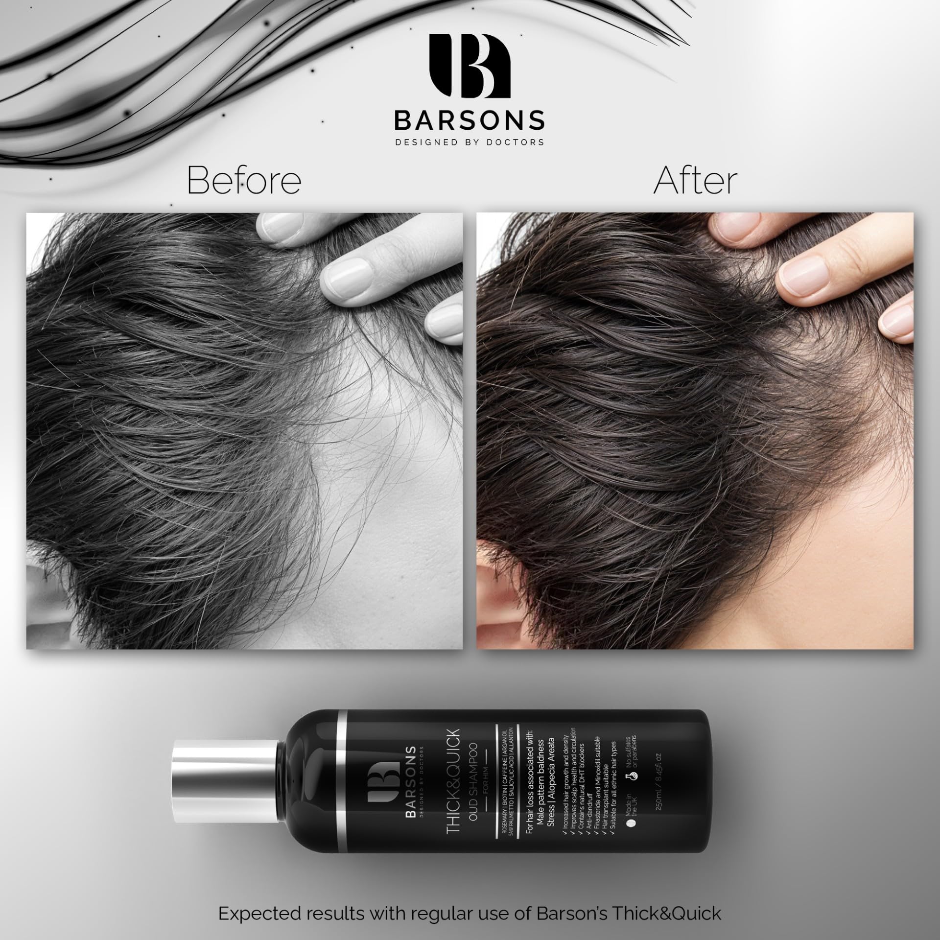 BARSONS THICK&QUICK Oud Shampoo for Men with Thinning Hair – Doctor-Formulated Hair Thickening Treatment – DHT Blocker – Hair Transplant Friendly – Rosemary, Biotin, Argan Oil, Caffeine – Sulfate-Free
