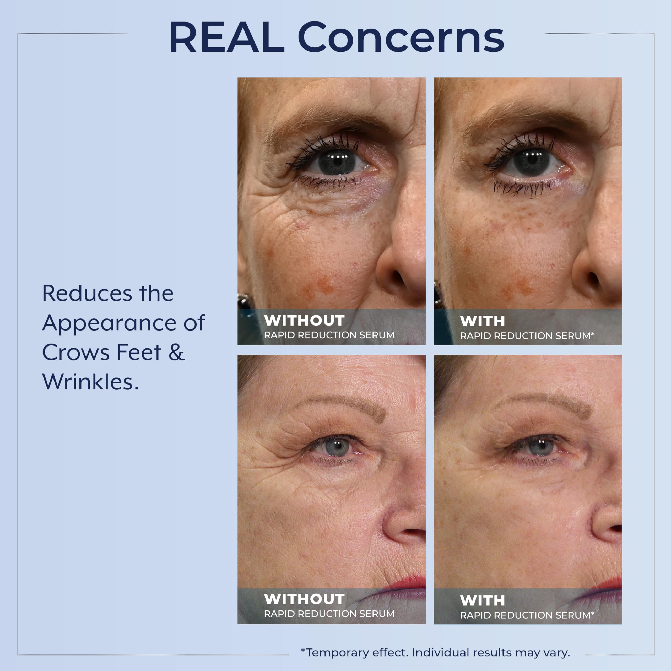 Plexaderm Rapid Reduction Eye Serum - Visibly Reduces Under-Eye Bags, Wrinkles, Dark Circles, Fine Lines & Crow's Feet Instantly, Anti Aging Wrinkle Remover for Face, Pump