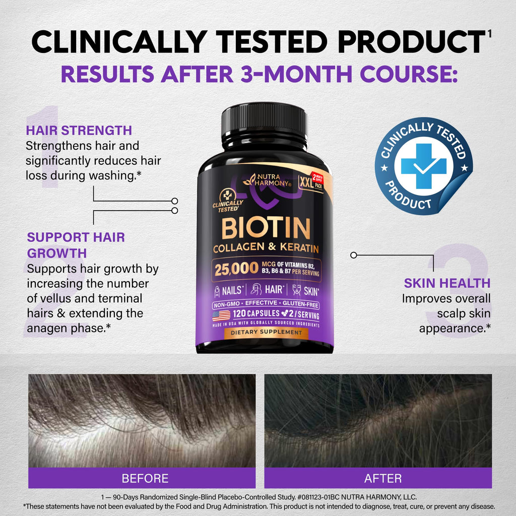 Biotin | Collagen | Hyaluronic Acid | Keratin - Support Normal Hair Growth Cycle, Skin & Nails - Clinically Tested - 25000mcg Vitamins B1, B2, B3, B6 & B7 - for Women & Men - 120 Capsules