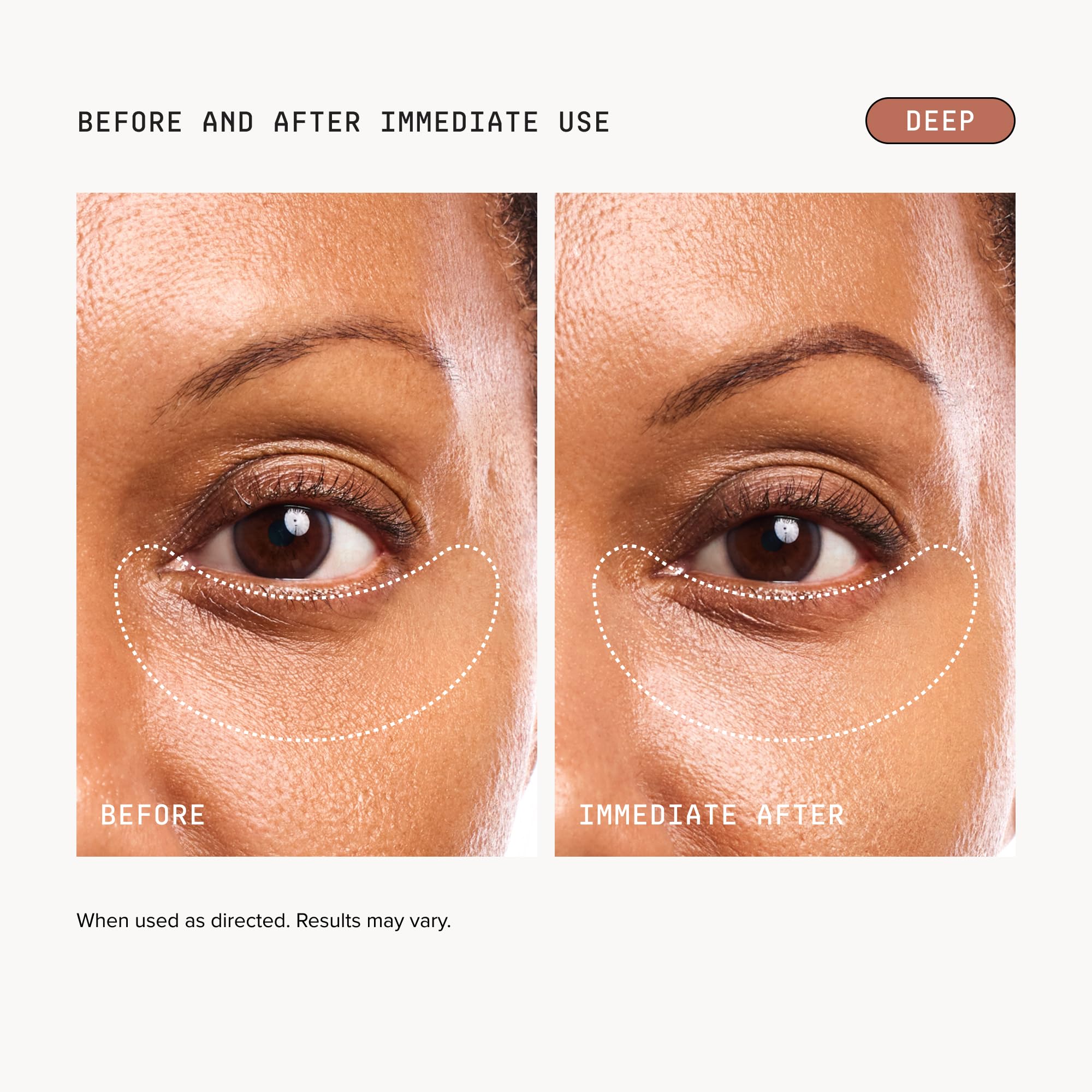 DRMTLGY Luminous Eye Corrector SPF 41, Under Eye Color Corrector for Dark Circles, Anti-Aging Tinted Eye Cream, Hydrating Eye Serum with Peach Undertone, Deep