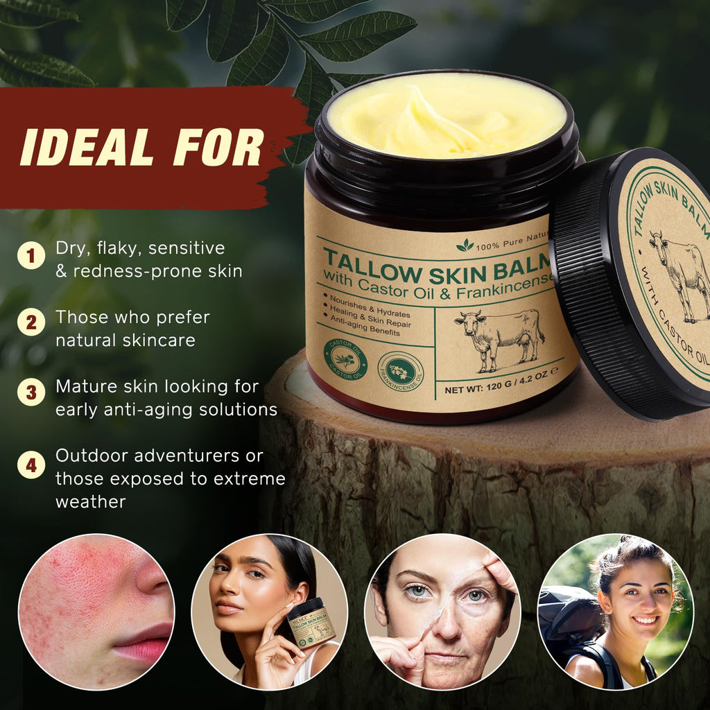 Tallow Balm With Castor Oil and Frankincense Balm, 100% Grass-Fed Beef Tallow Skin Care, Face & Body Moisturizer Cream for Skin, Nourish & Repairing Dry Skin
