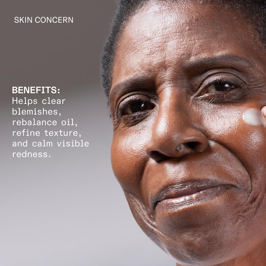facetheory Blemicalm Azelaic Acid 15% Clarifying Serum (Unscented) - Control Blemishes, Redness & Breakouts with Powerful Azelaic Acid Serum - Azelaic Acid Cream for Clearer Skin (30 ml)