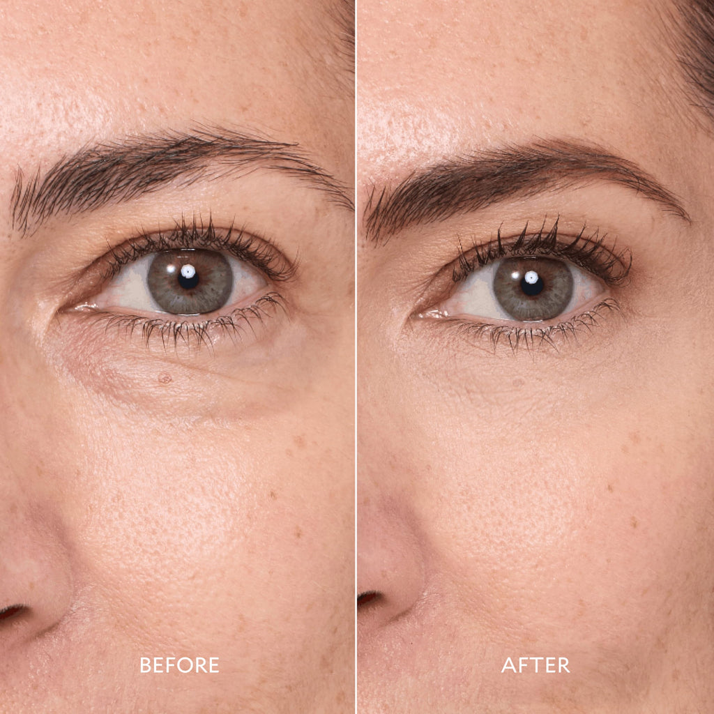 GATINEAU Miracle Eye Contour Cream 11ml x2