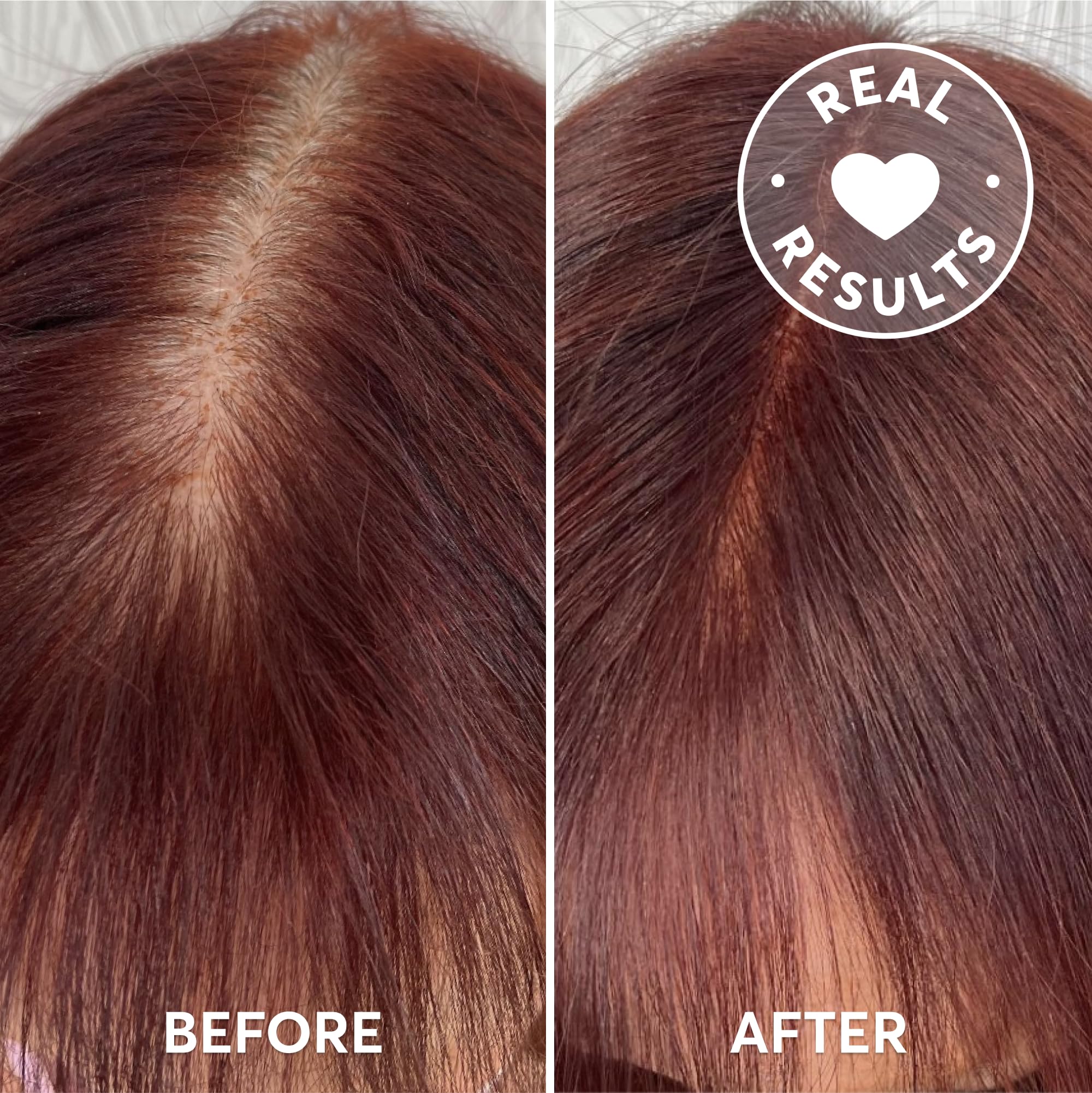 Madison Reed Root Perfection Root Touch Up Kit for T-Zone – 6R Pesaro Red, 2 Permanent Applications, Gray-Blending Color in 10 Min | PPD-Free & Ammonia-Free, Includes Hydrating Hair Mask