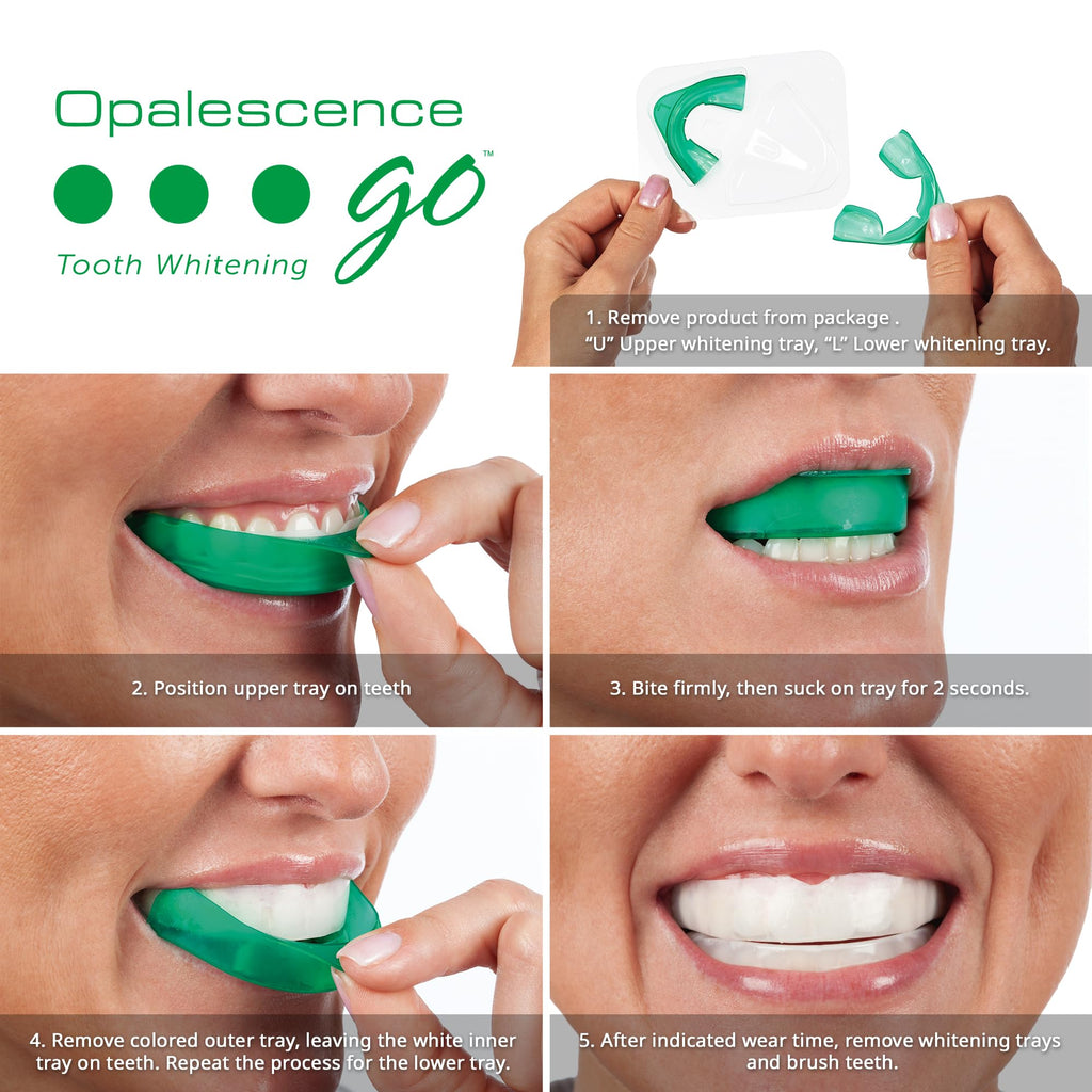 Opalescence Go 15- Prefilled Teeth Whitening Trays Kit - 15% Hydrogen Peroxide - (10 Treatments) Dentist Recomended - Made by Ultradent Products. Teeth Whitening Kit -Mint - 5194-1