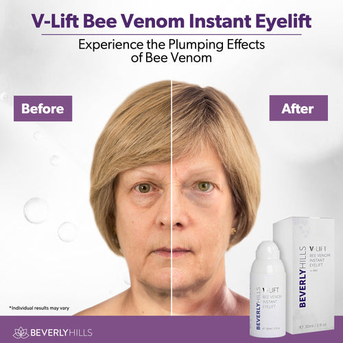 Beverly Hills V-Lift Instant Eye Lift and Eye Tuck Bee Venom Serum for Puffy Eyes, Dark Circles, Wrinkles, and Under Eye Bags Treatment for Women and Men | 30mL (120 Day Supply)