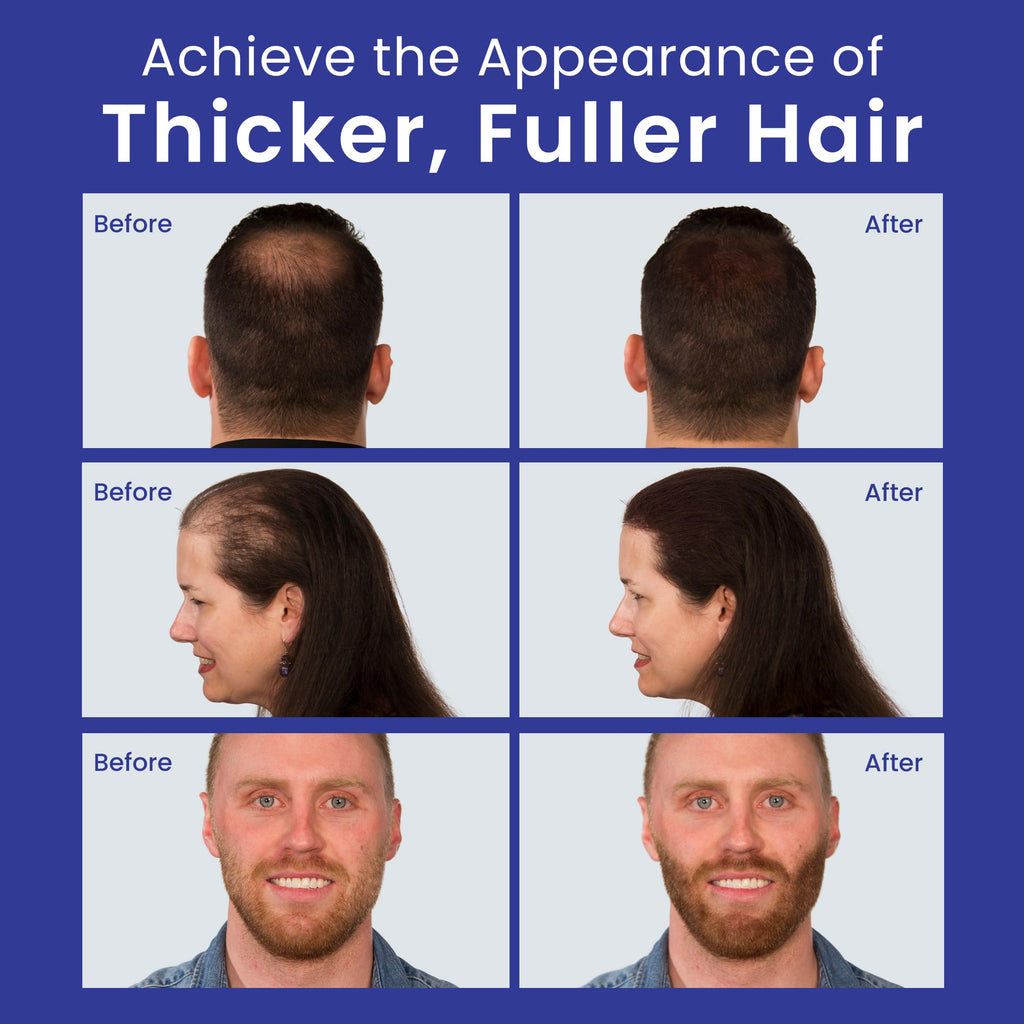 INFINITY Hair Fibers Dark Brown for Thinning Hair for Women & Men - 100% Undetectable Hair Building Fiber Powder - Conceal Hair Loss in 15 Seconds, 60g